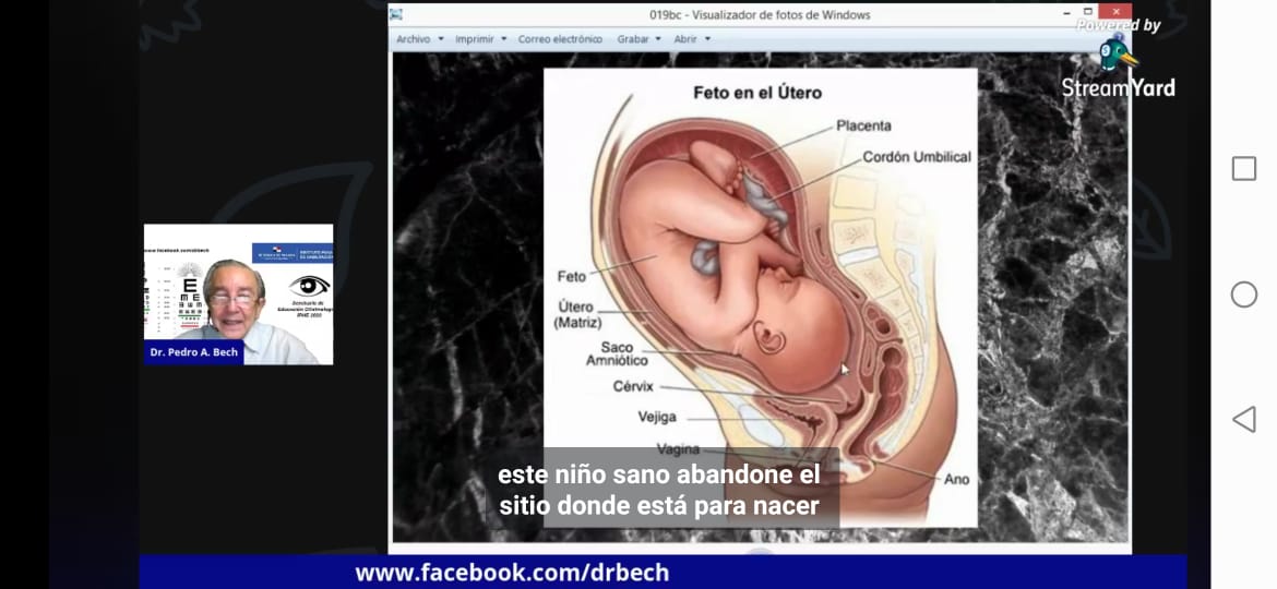 Influencia del embarazo, fecundación, fase embrionaria, parto y lactancia en la visión del recién nacido