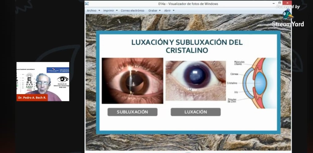 Las anomalías o patologías visuales, causas y efectos que pueden producir la ceguera o la baja visión desde el nacimiento